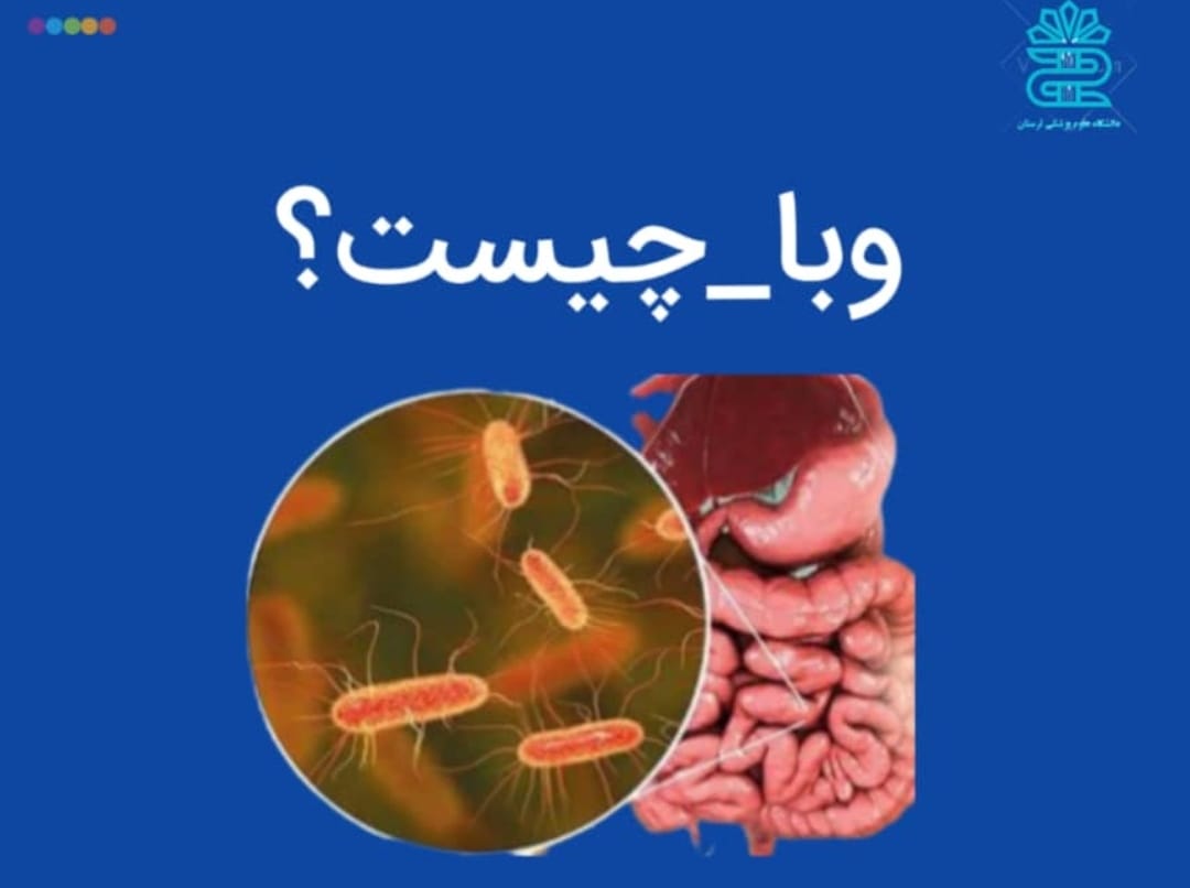 موردی از وبا در شهرستان خرم آباد گزارش نشده است