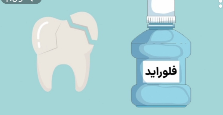 تاثیر دهانشویه و وارنیش فلوراید در پیشگیری از پوسیدگی دندان